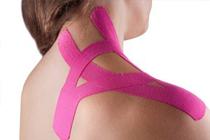 Тендинит сухожилия надостной мышцы Тендинит сухожилия надостной мышцы