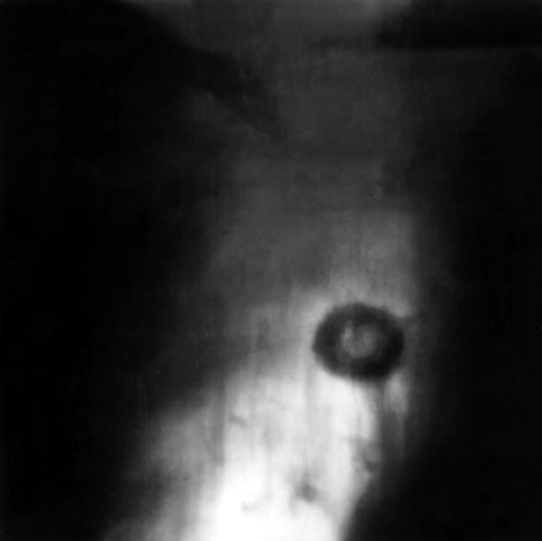 Туберкулема легких - что это такое и как выполнять лечение Туберкулема легких - что это такое и как выполнять лечение