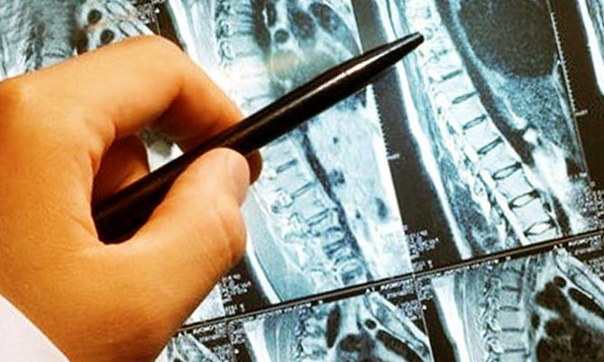 Лазерное лечение межпозвоночной грыжи Лазерное лечение межпозвоночной грыжи