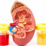 Что делать когда отказали почки? Что делать когда отказали почки?