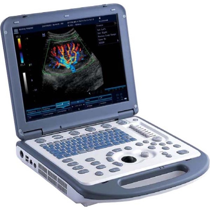 Методы ультразвуковой диагностики сосудов ног: разновидности и применение Методы ультразвуковой диагностики сосудов ног: разновидности и применение