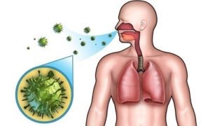 Основные симптомы воспаления легких у взрослых Основные симптомы воспаления легких у взрослых