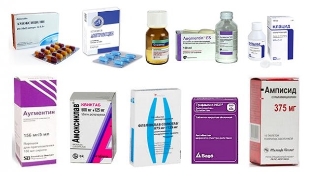 Основные симптомы воспаления легких у взрослых Основные симптомы воспаления легких у взрослых