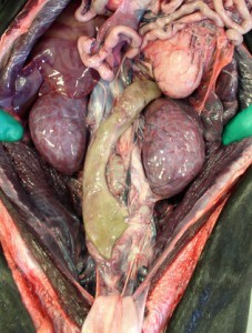 Классификация хронической болезни почек Классификация хронической болезни почек