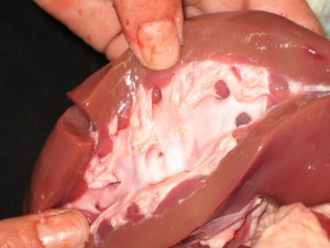 Классификация хронической болезни почек Классификация хронической болезни почек