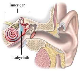 Хронический отит Хронический отит