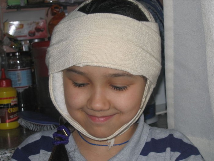 Хронический отит Хронический отит