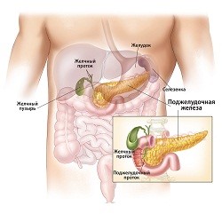 Причины появления калькулезного панкреатита и эффективные методы лечения Причины появления калькулезного панкреатита и эффективные методы лечения