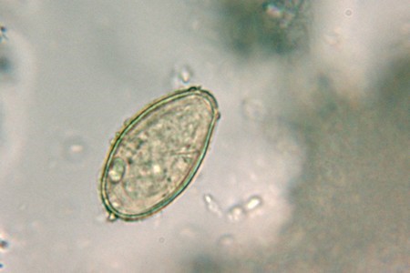 Как выглядят яйца глистов? Как выглядят яйца глистов?