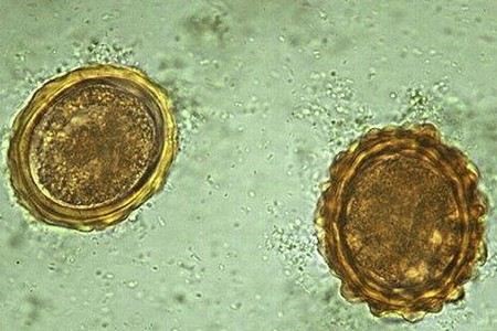 Как выглядят яйца глистов? Как выглядят яйца глистов?