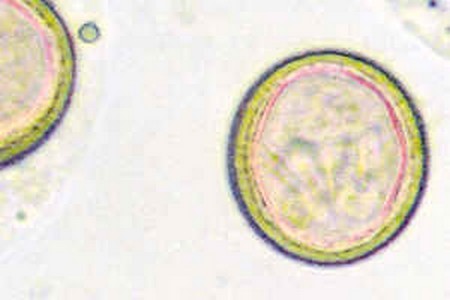 Как выглядят яйца глистов? Как выглядят яйца глистов?