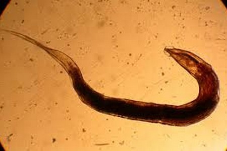 Как выглядят яйца глистов? Как выглядят яйца глистов?