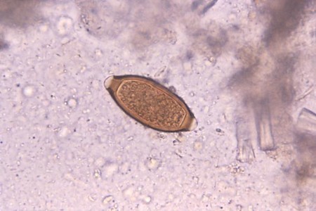 Как выглядят яйца глистов? Как выглядят яйца глистов?