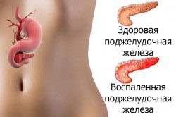 Есть ли жизнь без желчного пузыря? Есть ли жизнь без желчного пузыря?