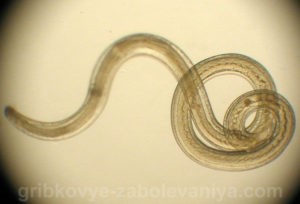 Жжение в заднем проходе: лечение Жжение в заднем проходе: лечение